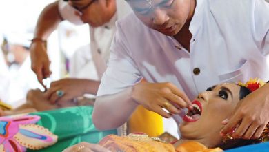 پر کردن دندان