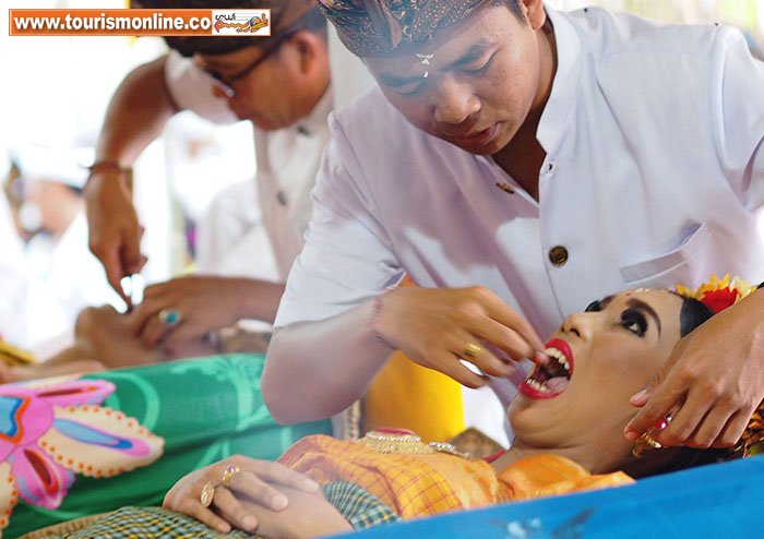 پر کردن دندان