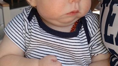 کودکی با جمجمه نصفه