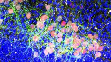 تصاویر رنگی و شگفت انگیز از مغز انسان