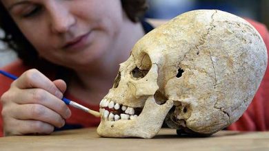 جراحی جمجمه امچراطوری روم