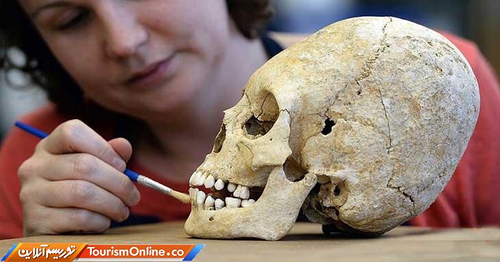 جراحی جمجمه امچراطوری روم