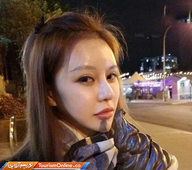 عمل جراحی دختر جوان