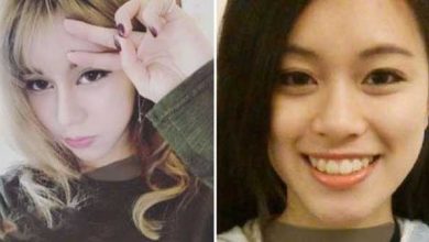 عمل جراحی دخنر جوان