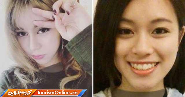 عمل جراحی دخنر جوان