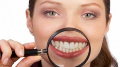 دندان های سفید