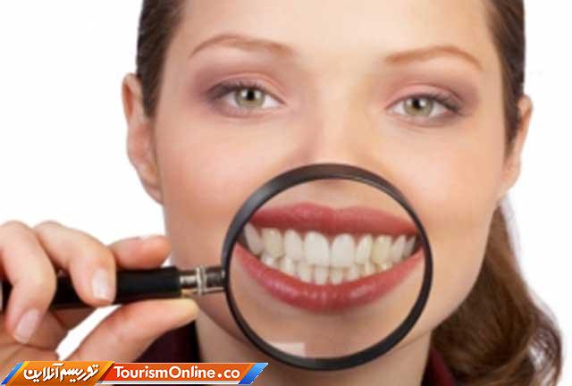 دندان های سفید