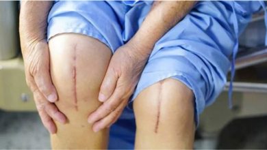 جراحی مفصل زانو