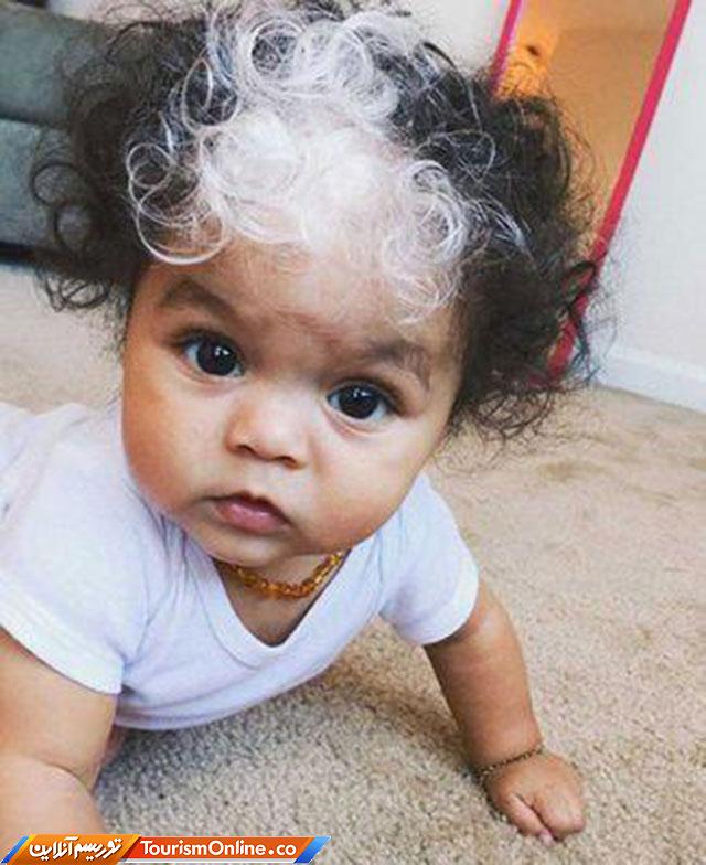 نوزاد با موهای سفید