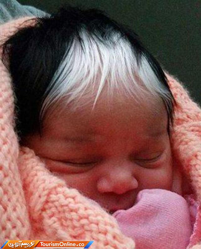 نوزاد با موهای سیاه و سفید