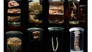 موزه انگل‌شناسی