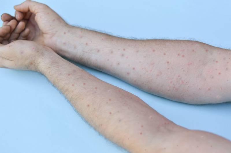 ویروس جدید چیست و چقدر ترسناک است؟ آنفلوانزای گوجه فرنگی !