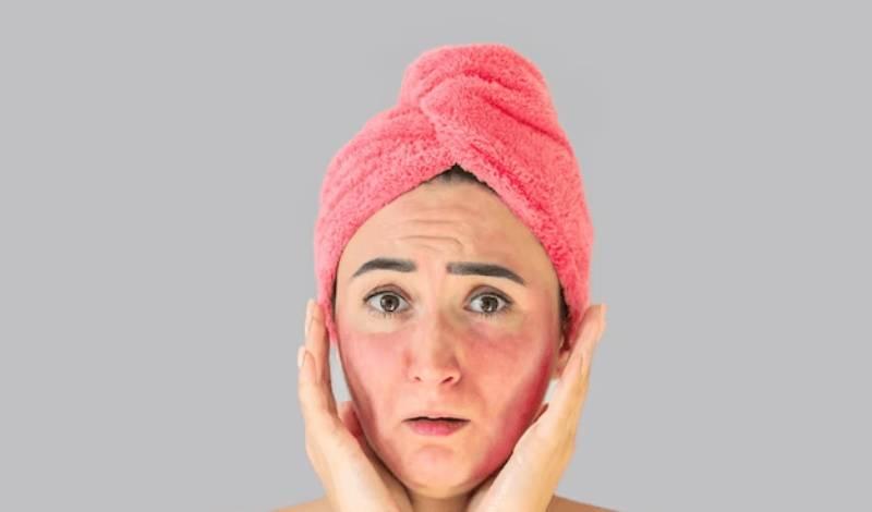 مراقبت از پوست