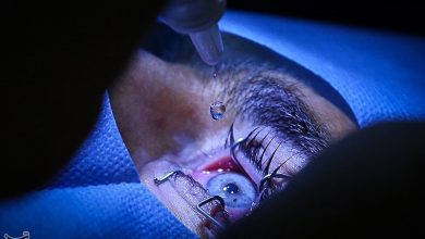 عمل تغییر رنگ چشم