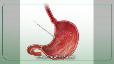 بوتاکس معده